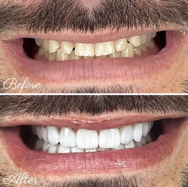 Miami Dentist Near Me - Smiles Gallery